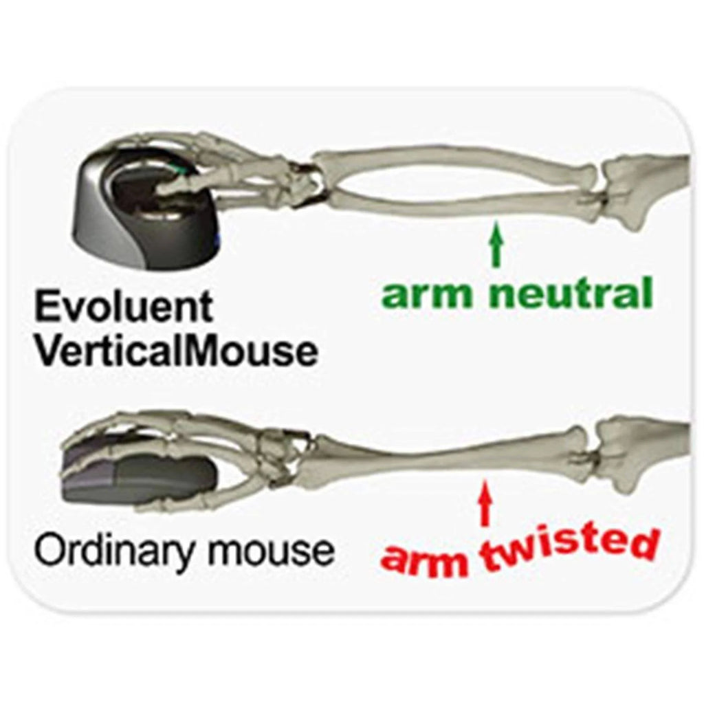 Vertical Mouse Right 4 k7